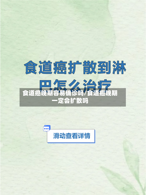 食道癌晚期容易确诊吗/食道癌晚期一定会扩散吗