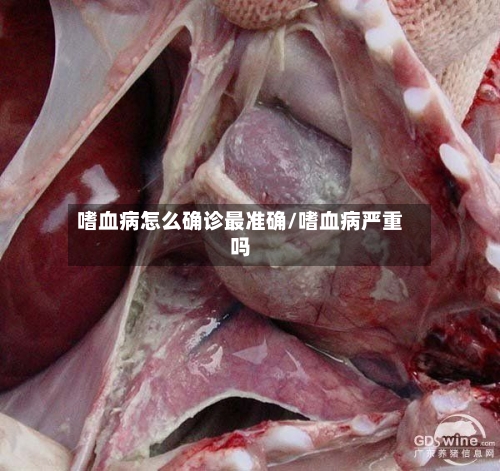 嗜血病怎么确诊最准确/嗜血病严重吗-第2张图片