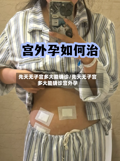 先天无子宫多大能确诊/先天无子宫多大能确诊宫外孕-第2张图片